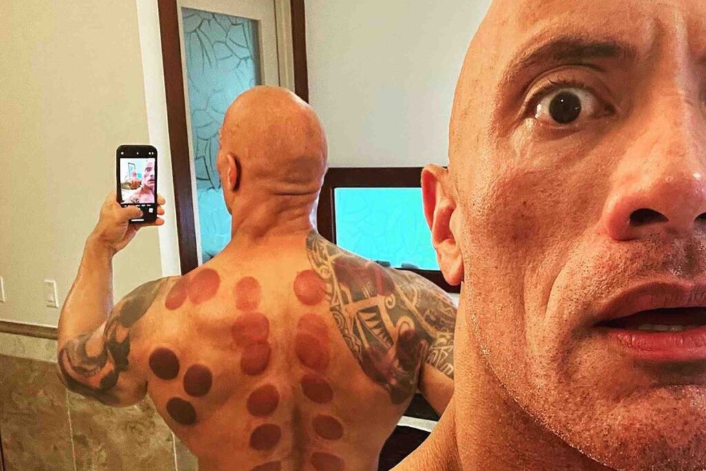 TheRock-Cupping
